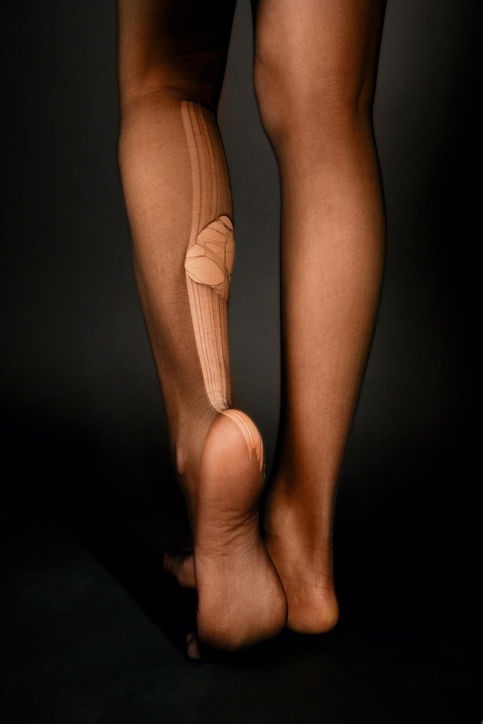 A woman in laddered stockings | Source: Getty Images